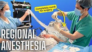 How anesthesiologists numb specific body parts actual video of a nerve block