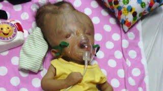 Toddler with Birth Defects Incompatible with Life Defies Odds in Venezuela