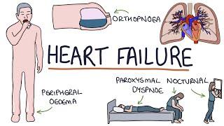 Understanding Heart Failure Visual Explanation for Students