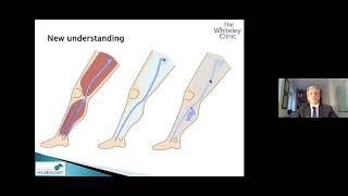 Venous disease and varicose veins treatments - Webinar by Prof Mark Whiteley