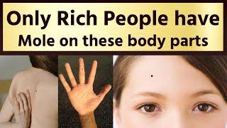 Only Rich People Have Mole on These Body Parts  Samudrik shastra