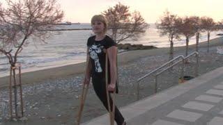 amputee woman crutching part 1
