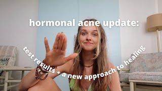 What Im doing to Heal my Hormonal Acne + My Dutch Test Results