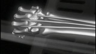 Wolverine claws x-ray