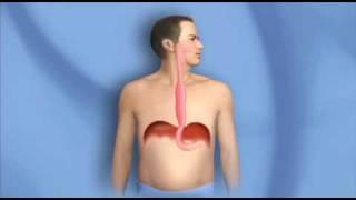 Surgery for Esophagus Cancer Esophagectomy - Mayo Clinic