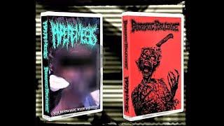 HYPEREMESIS  PANCREATIC PURULENCE - Split Tape 2016