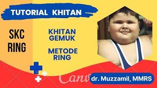 CINCIN KHITAN SKC UNTUK ANAK GEMUK