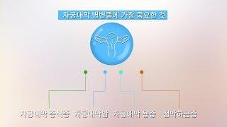 비정기자궁출혈의 원인