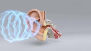 Explore the Science of Hearing Loss  Miracle-Ear Hearing Center