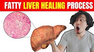 How Long Does Fatty Liver Take to Heal?  Complete Recovery Guide 2024