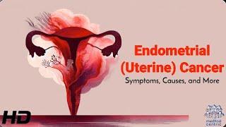 Endometrial Uterine Cancer Early Warning Signs You Shouldnt Ignore