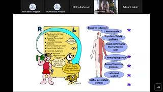 MDH Stroke Monthly Education Series Mysterious Stroke Case Studies Oct 2022