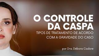 Qual o melhor tipo de de tratamento para caspa?  Dra. Débora Cadore