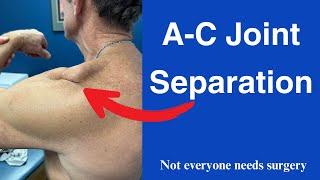 A-C Joint Separation non surgical