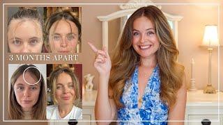5 STEPS - How I repaired & grew my broken thinning hair in just 12 weeks