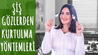 Şiş Gözler ve Göz Altı Torbalarından Kurtulmak için 4 Harika Çözüm