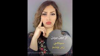 سیاهی وگودی زیر چشم COVER & CONCEAL EYE BAGS