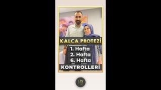 KALÇA PROTEZİ  1. HAFTA  2. HAFTA  6. HAFTA DEĞİŞİM SÜRECİ