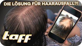 Kein Haarausfall mehr Neue Haar-Wachstumsbehandlung?  taff  ProSieben