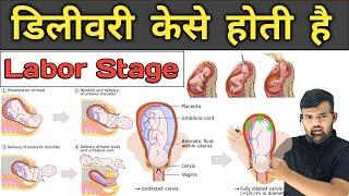 डिलीवरी केसे होती है  Labor Stage  Pregnancy  Medicine  Treatment  Hospital Knowledge  Doctor