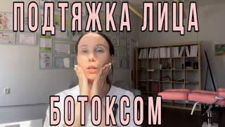 Ботокс. Подтягиваем овал лица. Лифтинг Нифертити. Осложнения ботокса плохо всталне держится ботокс