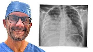 Read and Understand a Chest Xray - How I Do it