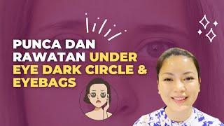 Beauty Tips  Punca & Rawatan Under eye Dark Circle dan Eyebags