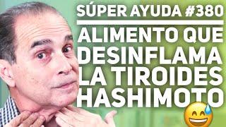 SÚPER AYUDA #380 E Alimento Que Desinflama La Tiroides Hashimoto