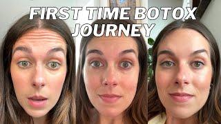 GETTING BOTOX FOR THE FIRST TIME Why I did it my experience and results