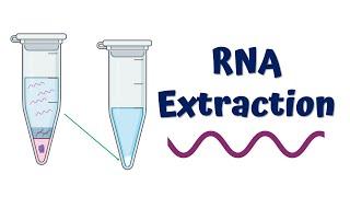 RNA Extraction  Principle and Process