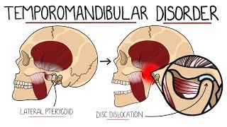 Temporomandibular Joint Disorder Explained TMJ Dysfunction  Includes Treatment & Anatomy