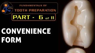 Fundamentals of tooth preparation  Part 6  Convenience form