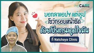 รีวิวดูดไขมันเหนียง ดูดไขมันกรอบหน้า ที่ Natchaya Clinic บอกลาแอปฯ บีบหน้า พร้อมโชว์หน้าสดแล้วค่าาา