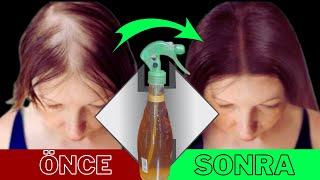 Everyone loves this easy inexpensive and effective hairspray recipe. No Hair Loss