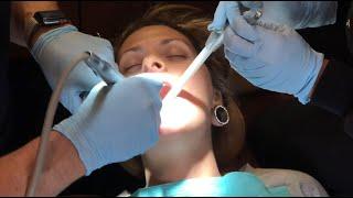 Dental Drilling  Dental Filling  Dent Economy  Dentist  Dental