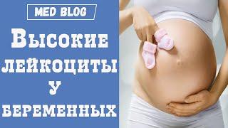 Высокие лейкоциты у беременных  Норма лейкоцитов у беременных  Основные причины высоких лейкоцитов