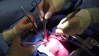 Teaching Cardiac Procedures using Ramphal Cardiac Surgery Simulator