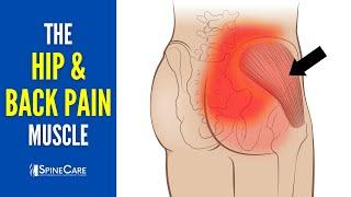 The Lower Back and Hip Pain Muscle How to Release It for INSTANT RELIEF