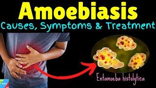 Amoebiasis  Amebiasis  Amoebic Dysentery – Symptoms Causes Treatment Complications Preventions