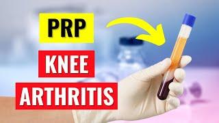 Discover the Power of PRP Injections for Knee Arthritis