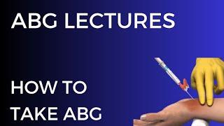 How to take an ABG ?