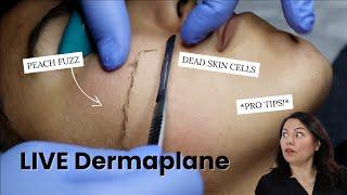 LIVE DERMAPLANE Q&A WITH MASTER AESTHETICIAN  #Skincare