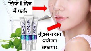 1 दिन में मुंहासे और दाग - धब्बे को हल्का करने वाली जबरदस्त चाईनीज क्रीम - Bioaqua Cream