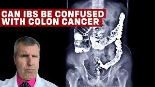 IBS vs. Colon Cancer Understanding the Differences and Similarities