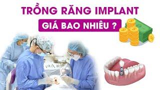 Trồng răng Implant giá bao nhiêu?