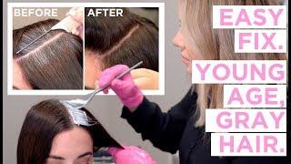 Young Age Gray Hair - An Easy Fix