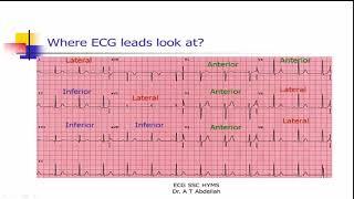 Advanced ECG Interpretation course - 2 Basic ECG