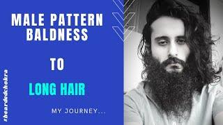Male Pattern Baldness To Long Hair Naturally - My Journey  Hair Growth Phase  Bearded Chokra