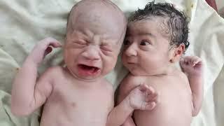 Twins after birth where one is fed up with other one cry  Just Stop It 