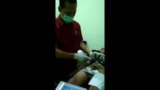 Khitan STAPLER di PUSAT HYPNOKHITAN Griya Medika MAGETAN...081335355444